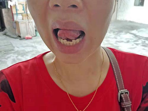 妇科炎症