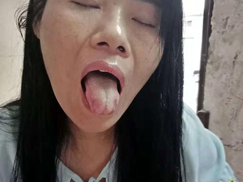 盆腔炎