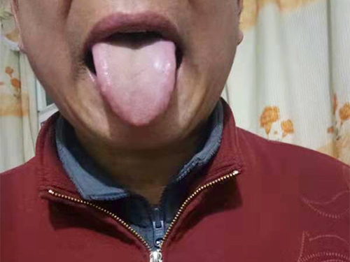 成功案例