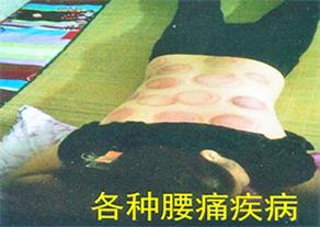 153、各种腰痛疾病.jpg